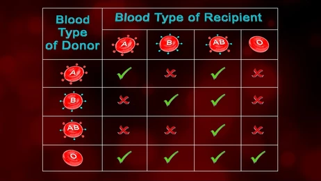 Blood Type matching for Transplant