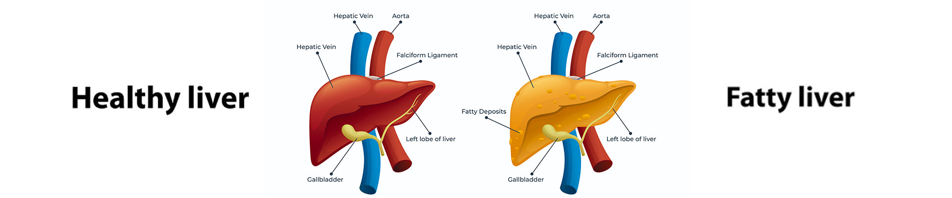 Hepatic Artery vital for Liver Transplants